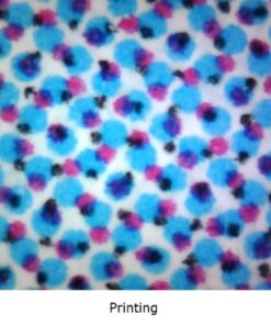 Vividia USB Digital Borescope Microscope with Professional Multi-Functional Metal Stand 12mm Diameter OTG Android and USB PC 27 51PyKtOqt2L