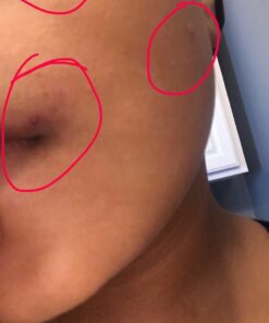 African Black Soap Paste 8 oz. 100% Raw Pure Natural From Ghana. Acne Treatment, Aids Against Eczema & Psoriasis, Dry Skin, Scars and Dark Spots. Great For Pimples, Blackhead, Face & Body Wash. Unscented 8 Ounce (Pack of 1) 51 51QM7IGCOsL