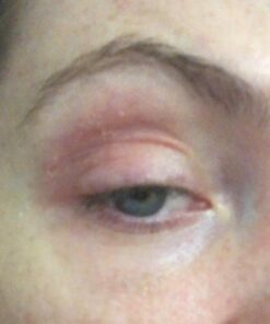 Hydrating Face Moisturizer & Body Cream with Manuka Honey Cream - Organic Face Moisturizer & Body Lotion for Extremely Dry Skin - For Dry & Itchy Skin, Rosacea & Eczema Prone Skin (Original, 2oz) Original 2 Ounce (Pack of 1) 44 51QukGewhxL