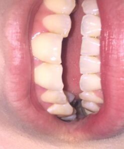 Whitening Tooth Powder with Activated Charcoal for Teeth and Gums (Cool Peppermint) - Safe on Enamel, Detoxifying, Plant-Based and Cruelty Free 2.75 Ounce (Pack of 1) 30 51RpjJ 4WL