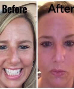 SkinMedica HA5 Rejuvenating Hydrator Hyaluronic Acid Serum for Face with Five Types of Hyaluronic Acid that Smooth Fine Lines and Wrinkles, For All Skin Types, 2 Oz 2 Ounce (Pack of 1) 24 51TjtyR4NXL