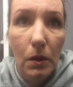 Tree of Life Retinol Serum for Face w/Hydrating Hyaluronic Acid for Wrinkle Soothing, Fine Lines & Dark Spots - 2 Fl Oz - Renew & Reset Nighttime Serums - Dermatologist Tested Facial Skin Care 2 Fl Oz (Pack of 1) 37 51UOm8sJtkL