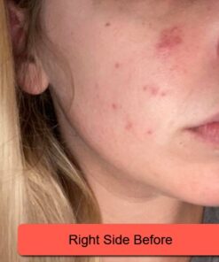 Silver Miracles Colloidal Silver Gel - Nano Silver Gel Wound Care - Healing Ointment for Burns, Sunburns & Irritated Skin - 4 Oz Unscented 53 51WH4tbVv L 1