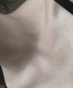 Truremedy Naturals Remedy Tea Tree Oil Body Wash - Body Wash That Helps Body Odor, Ringworm, & Skin Irritations - Tea Tree Soap Body Wash (1 pk, 12 oz) 12 Fl Oz (Pack of 1) 46 51X7Gr41zcL 2