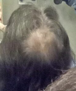 6 Months Kirkland Minoxidil 5% Extra Strength Hair Loss Regrowth Treatment Men, 12 Fl Oz (Pack of 6) 40 51XoDXVlJrL