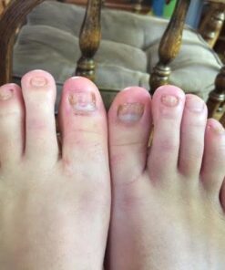 3 in 1 Professional Foot Spa Kit-with Tea Tree Foot & Body Soak-Tea Tree Body Wash & Nail Blend-Soothes Dry, Burning & Itchy Skin-Refreshes Unwanted Foot Odor-Restores Unhealthy Nails-Purely Northwest Tea Tree Oil 3 Piece Set 48 51Yt74ok6lL 1