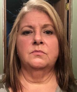 Enhanced Hair Straightener Heat Brush by MiroPure, 2-in-1 Ceramic Ionic Straightening Brush, Hot Comb with Anti-Scald Feature, Auto Temperature Lock & Auto-Off Function (Pink) 4 Piece Set Pink 38 51b8PiBP7GL