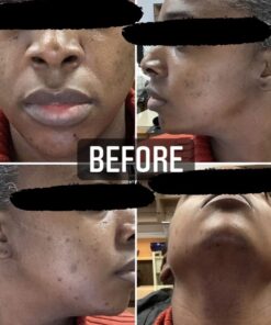 Organic African Black Soap - For Acne & Dark Spots | Natural Vegan and Cruelty Free – Satisfaction Guarantee 1lb bar | 90 day Supply 1 Pound (Pack of 1) 55 51bS7DqUSQL