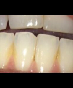 Dental Hygiene Kit - Calculus & Plaque Remover Dental Tool Set - Stainless Steel Tarter Scraper, Tooth Pick, and Mouth Mirror - Dentist Instrument Set for Teeth Cleaning (Blue) Blue 60 51di6mURkjL