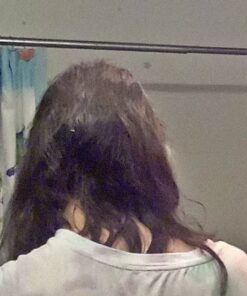 6 Months Kirkland Minoxidil 5% Extra Strength Hair Loss Regrowth Treatment Men, 12 Fl Oz (Pack of 6) 41 51dm DThypL