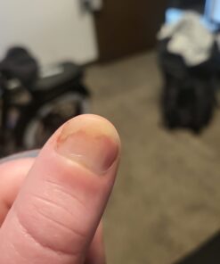 Kerasal Nail Renewal, Restores Appearance of Discolored or Damaged Nails, 0.33 fl oz (Packaging May Vary) 39 51fHiRqTtKL