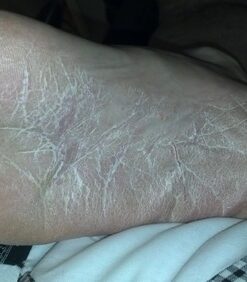 Fungi Nail Anti-Fungal Ointment, Kills Fungus That Can Lead to Nail & Athlete’s Foot with Tolnaftate & Clinically Proven to Cure Infections, Natural Color, 0.7 Fl Oz 31 51guFH3v2zL