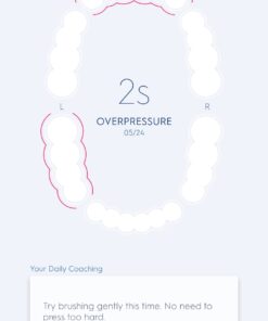 Oral-B Pro 5000 Smartseries Power Rechargeable Electric Toothbrush with Bluetooth Connectivity, White Edition 1 Count (Pack of 1) 40 51hKOEsHAsL