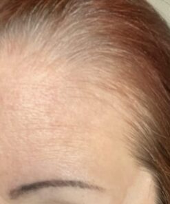 Hairgenics Pronexa Clinical Strength Hair Growth & Regrowth Therapy Hair Loss Shampoo With Biotin, Collagen, and DHT Blockers for Thinning Hair, 8 fl. oz. 55 51i3yGBw7fL