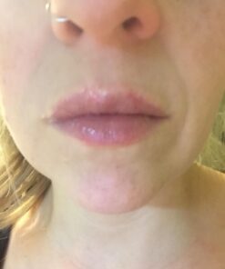 Lansinoh Lanolin Nipple Cream, Safe for Baby and Mom, Breastfeeding Essentials, 3 Mini Tubes, Each 0.25 Ounces 0.25 Ounce (Pack of 3) 35 51iq19F9hqL