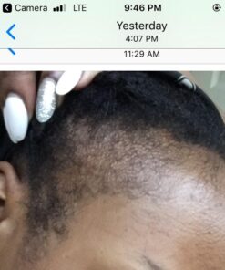 Wild Growth Hair Oil 3pcs x 4oz 4 Fl Oz (Pack of 3) 25 51lpyXMoYSL