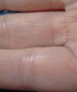 Dr. Scholl's Clear Away WART Remover HYDROGEL Bandage // 12 Discs/9 Cushions, Clinically Proven, Immediate & All-Day Cushioning Pain Relief, Multi-Day Coverage, 12 Treatments 41 51mCgaJ7HSL