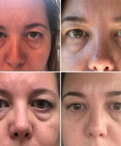 Organys Spark Rejuvenating Eye Formula, 0.5 oz/15 ml 42 51mTVpVReaL