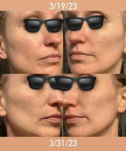 DearKlairs Freshly Juiced Vitamin Drop, 5% Hypoallergenic pure vitamin C serum, 1.18oz | ascorbic acid vitamin c serum, antioxidant serum for face, korean skincare 34 51n9CXn6BHL