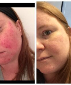 Teddie Organics Rose Water Facial Toner Spray 2oz 2 Fl Oz (Pack of 1) 28 51nEi9uR34L