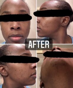 Organic African Black Soap - For Acne & Dark Spots | Natural Vegan and Cruelty Free – Satisfaction Guarantee 1lb bar | 90 day Supply 1 Pound (Pack of 1) 56 51nkpiiUnfL 1