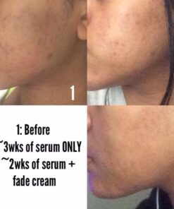 DearKlairs Freshly Juiced Vitamin Drop, 5% Hypoallergenic pure vitamin C serum, 1.18oz | ascorbic acid vitamin c serum, antioxidant serum for face, korean skincare 40 51o4YHci0RL