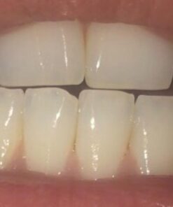 Dental Hygiene Kit - Calculus & Plaque Remover Dental Tool Set - Stainless Steel Tarter Scraper, Tooth Pick, and Mouth Mirror - Dentist Instrument Set for Teeth Cleaning (Blue) Blue 61 51p4MPJiLCL