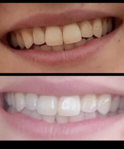 Whitening Tooth Powder with Activated Charcoal for Teeth and Gums (Cool Peppermint) - Safe on Enamel, Detoxifying, Plant-Based and Cruelty Free 2.75 Ounce (Pack of 1) 27 51sU7pzO9BL