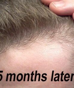 Maxx Beard -#1 Beard Growth Solution, Natural Solution for Maximum Beard Volume-2 Month Supply 25 51uhDLCVgYL