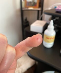 Active Skin Repair Hydrogel - Natural & Non-Toxic First Aid Ointment & Antiseptic Gel for Minor Cuts, Wounds, Scrapes, Rashes, Sunburns, and Other Skin Irritations (Single, 3 oz Gel) 3 Fl Oz (Pack of 1) 36 51vafHrC2JL