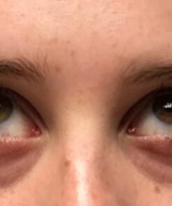 Deluxe Collagen Eye Mask Collagen Pads For Women By Purederm 2 Pack Of 30 Sheets/Natural Eye Patches With Anti-aging and Wrinkle Care Properties/Help Reduce Dark Circles and Puffiness 38 51z4nR2o8ML