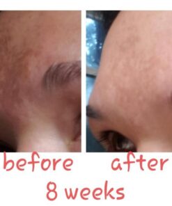 ASTERWOOD NATURALS Triple Repair Matrixyl 3000 + Argireline + Hyaluronic Acid + Organic Vitamin C Serum for Face; Anti-Aging Face Serum, Anti-Wrinkle Serum, Facial Skin Serum Skin Care, 118ml/4 oz Triple Repair - Unscented 4 Fl Oz (Pack of 1) 37 51zc9Dht9 L