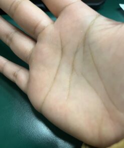 Compound W Maximum Strength Fast Acting Liquid Wart Remover, 0.31 fl oz 39 61 4a3oMF1L