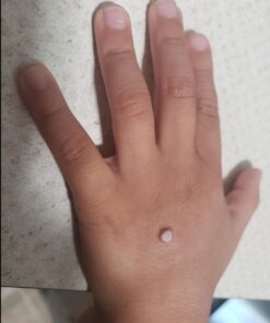 Compound W Maximum Strength Fast Acting Liquid Wart Remover, 0.31 fl oz 48 61 5rUSK6L