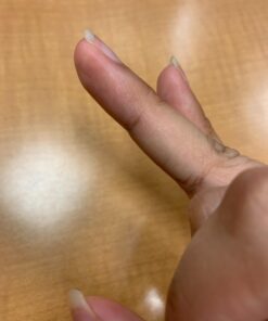 Dr. Scholl's Clear Away WART Remover HYDROGEL Bandage // 12 Discs/9 Cushions, Clinically Proven, Immediate & All-Day Cushioning Pain Relief, Multi-Day Coverage, 12 Treatments 28 61 rtNQS8GL