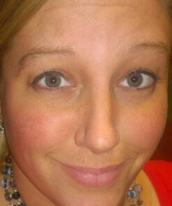 InstaNatural BHA Exfoliating Face Serum, Minimizes Lines, Wrinkles, and Blemishes, with Vitamin C and Salicylic Acid, 1 Fl Oz 37 610Dom26gvL