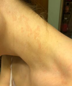 PURELY NORTHWEST-Natural Tea Tree & Peppermint Body Wash for Men & Women-Refreshing Daily Soap for Body Odor & Hygiene, Acne-Effectively Soothes Jock Itch, Chafing & Athletes Foot-Discolored Nails-9oz 9 Fl Oz (Pack of 1) 55 6118DUceRBL