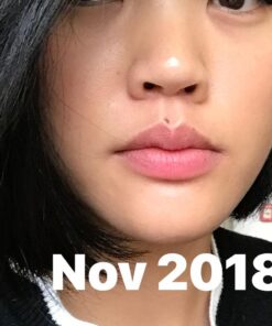 TruSkin Tea Tree Clear Skin Super Serum, Formulated with Tea Tree Oil, Vitamin C, Salicylic Acid, Niacinamide & Retinol, 1fl oz 1 Fl Oz (Pack of 1) 44 611T6b8ARL 3