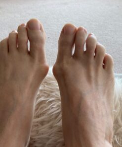 YogaToes GEMS: Gel Toe Stretcher & Separator - America’s Choice for Fighting Bunions, Hammer Toes (Small fits Shoe Sizes W: 7.5-11 / M: 7-10,) 1 Pair 37 611gkWKbJlL