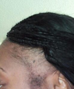 Wild Growth Hair Care System, 4 Fl Oz (Pack of 2) 28 6121xkBrVML