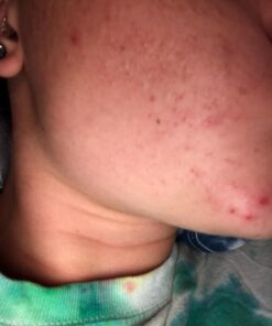 TruSkin Tea Tree Clear Skin Super Serum, Formulated with Tea Tree Oil, Vitamin C, Salicylic Acid, Niacinamide & Retinol, 1fl oz 1 Fl Oz (Pack of 1) 52 612oelllQyL 3