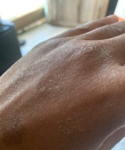 Gold Bond Healing Hydrating Lotion, 20 oz., With Aloe, Moisturizes, Immediate 24-Hour Hydration 20 Ounce (Pack of 1) 33 613HU2XdhxL