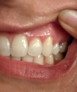 Living Libations - Organic Ozonated Happy Gum Gel | Natural, Wildcrafted, Vegan Clean Beauty (0.34 fl oz | 10 ml) 3 613edVBHYIL