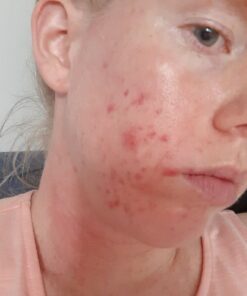 Silver Miracles Colloidal Silver Gel - Nano Silver Gel Wound Care - Healing Ointment for Burns, Sunburns & Irritated Skin - 4 Oz Unscented 37 613mdZUUnwL