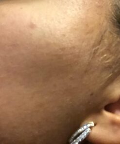 Emjoi Tweeze erase e6, Facial Hair Remover, Epilator 17 614E1HcHxIL