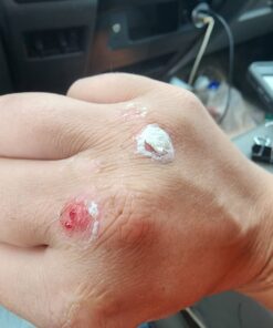 Compound W Maximum Strength Fast Acting Liquid Wart Remover, 0.31 fl oz 41 614ZI42jQL