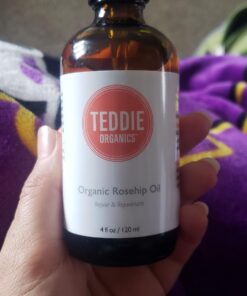 Organic Rosehip Oil – 100% Pure Unrefined Cold Pressed Rosehip Seed Oil - Best Moisturizer for Face, Hair - Great for Fine Lines, Wrinkles, Acne Scars, Sun Damage, Stretch Marks, Eczema, Psoriasis 4 Fl Oz (Pack of 1) 29 615VnRKUNlL