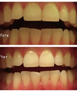 Whitening Tooth Powder with Activated Charcoal for Teeth and Gums (Cool Peppermint) - Safe on Enamel, Detoxifying, Plant-Based and Cruelty Free 2.75 Ounce (Pack of 1) 33 6161DyqO48L