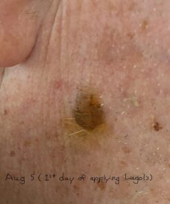 J.CROW'S® Lugol's Solution of Iodine 2% 2oz Unflavored 2 Ounce (Pack of 1) 30 617gR4P3HvL