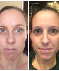 TOULON Glycolic Acid Cream 10% Face Moisturizer. Best Alpha Hydroxy Acid Products; Exfoliating, Anti-Aging Wrinkle Cream with AHA for Acne Prone Skin; Natural Exfoliator for Day and Night 46 617mv1UgPhL